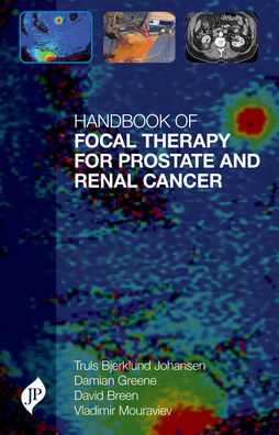 Handbook of Focal Therapy for Prostate and Renal Cancer
