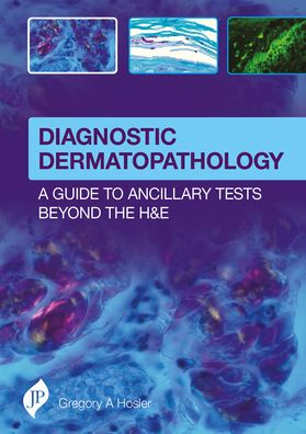 Diagnostic Dermatopathology: A Guide to Ancillary Tests Beyond the H&e: A Guide to Ancillary Tests Beyond the H&e