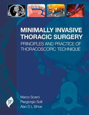 Minimally Invasive Thoracic Surgery