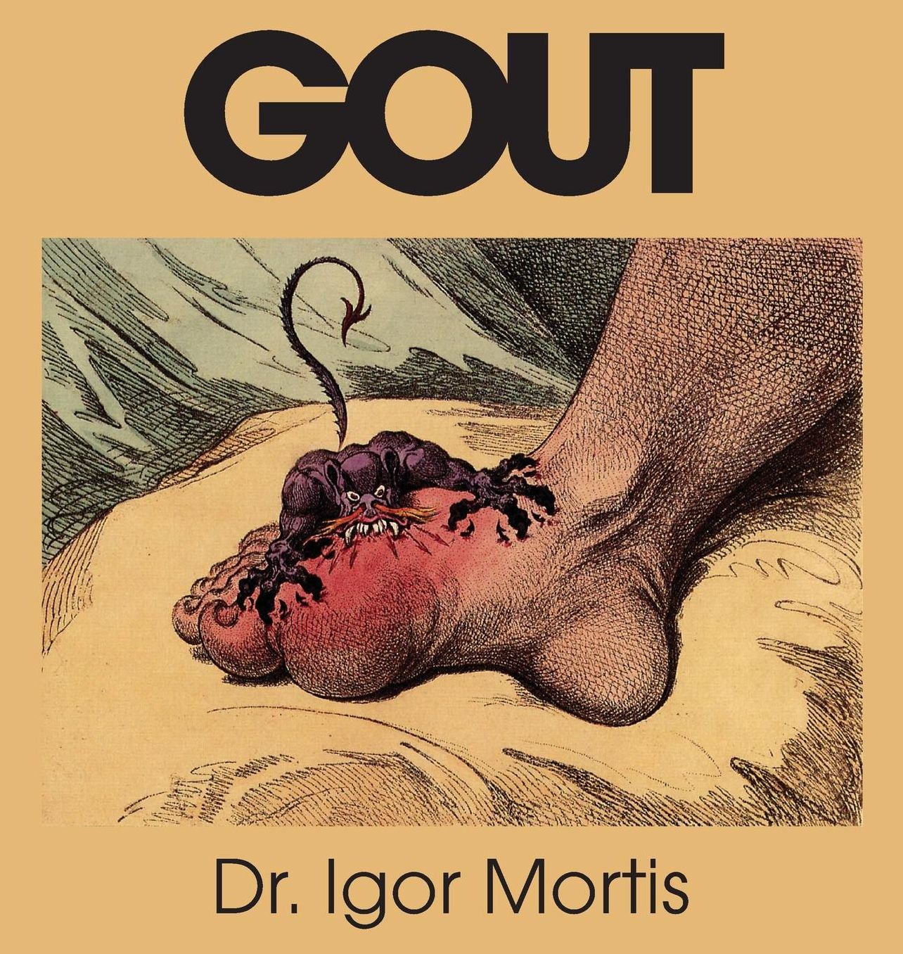 Gout