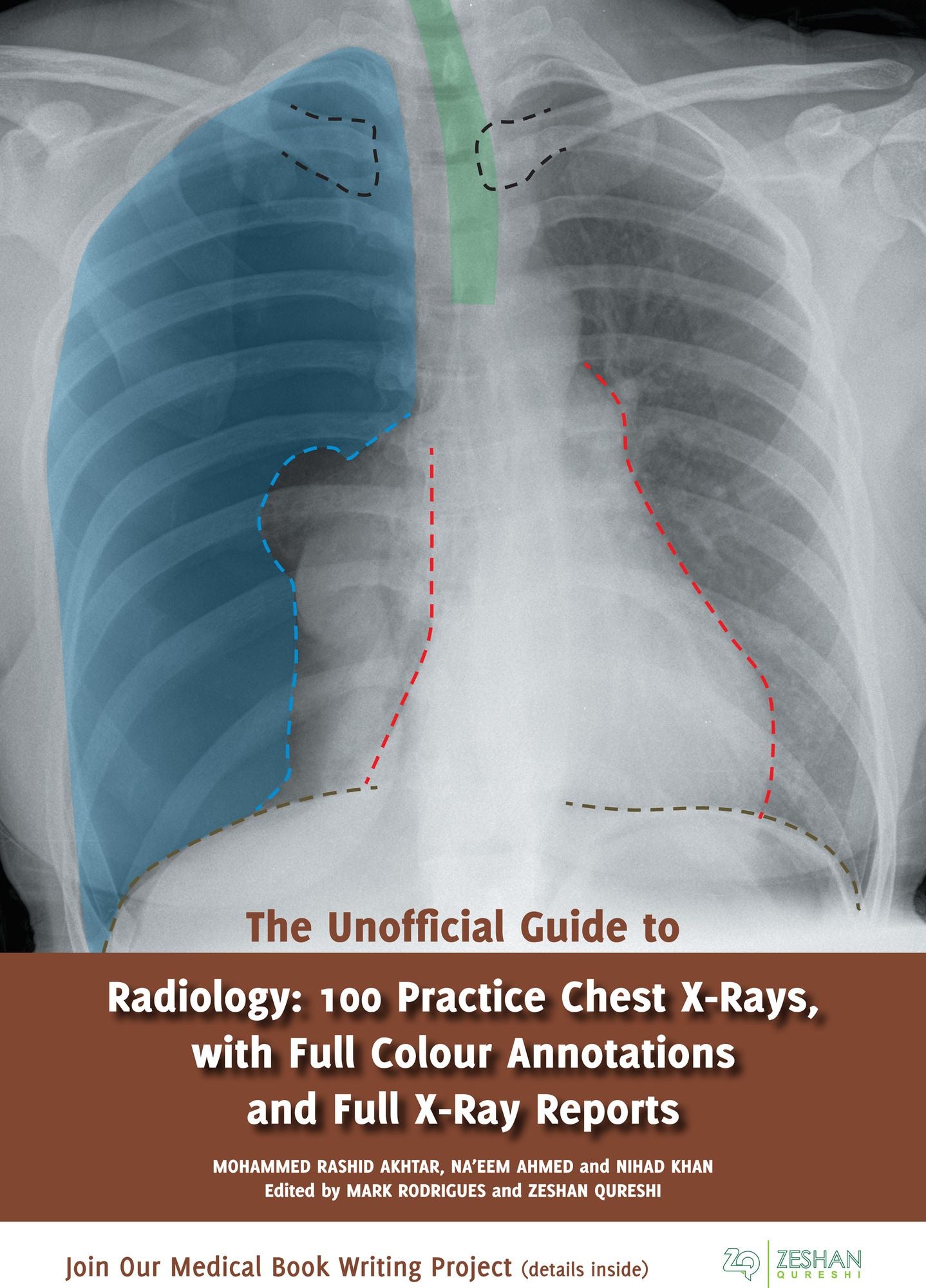 The Unofficial Guide to Radiology: 100 Practice Chest X-Rays, with Full Colour Annotations and Full X-Ray Reports
