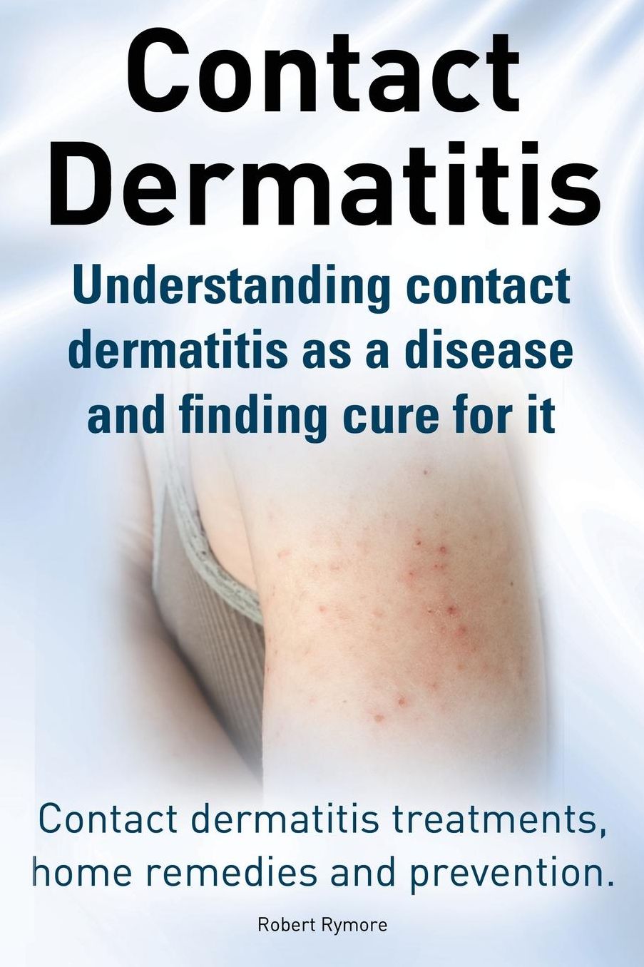Contact Dermatitis. Contact Dermatitis Treatments, Home Remedies and Prevention. Understanding Contact Dermatitis as a Disease and Finding Cure for It