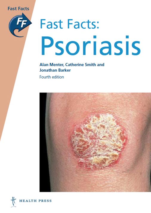 Fast Facts: Psoriasis