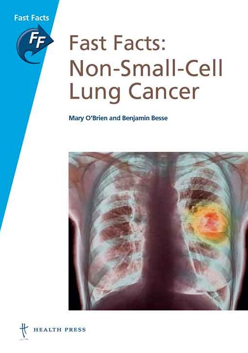 Fast Facts: Non-Small-Cell Lung Cancer: NSCLC