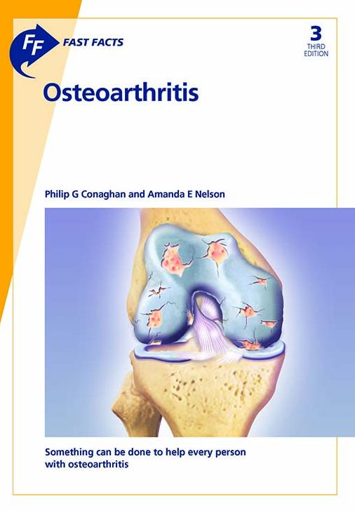 Fast Facts: Osteoarthritis