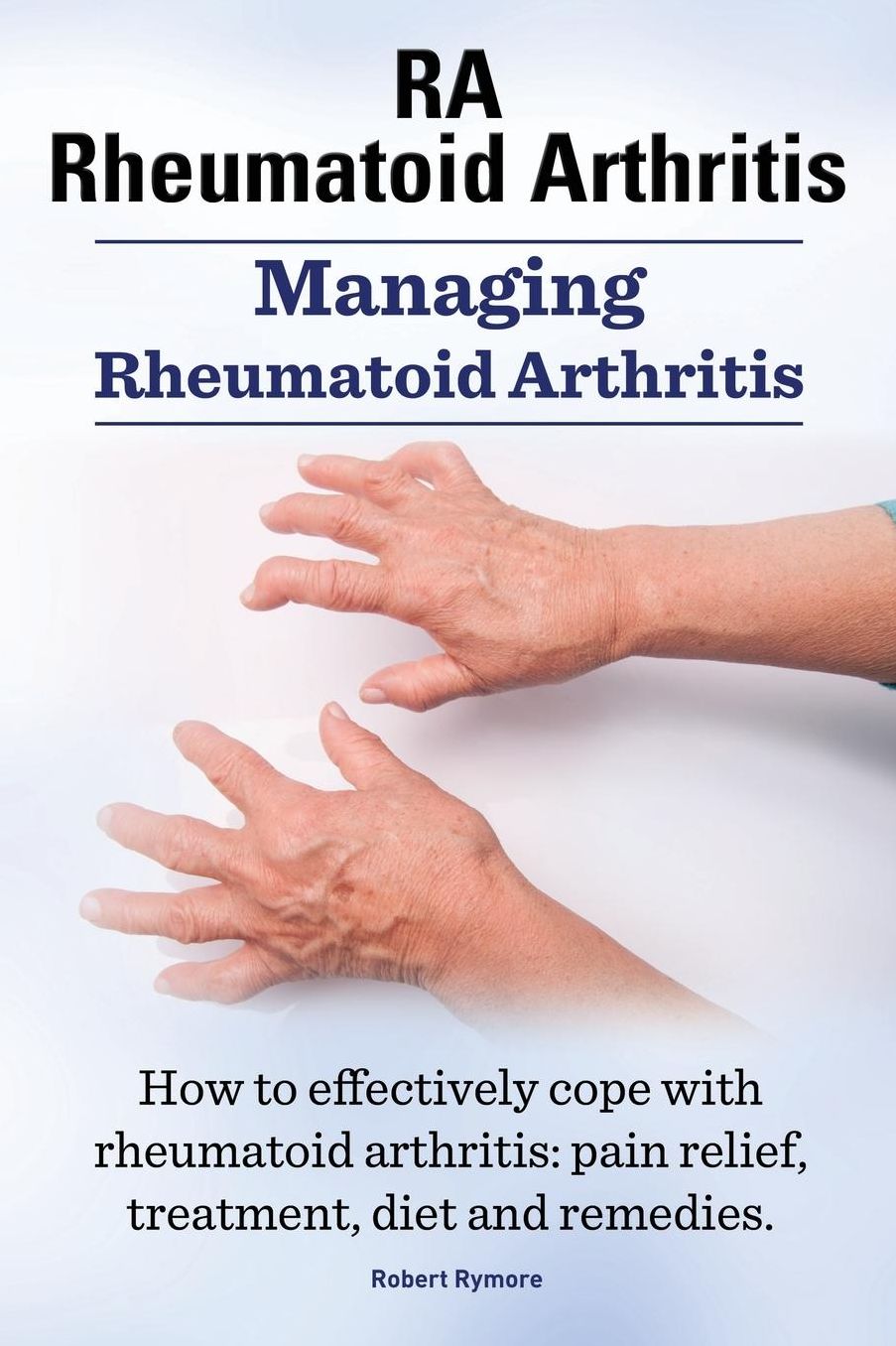 RA Rheumatoid Arthritis. Managing Rheumatoid Arthritis. How to effectively cope with rheumatoid arthritis: pain relief, treatment, diet and remedies..