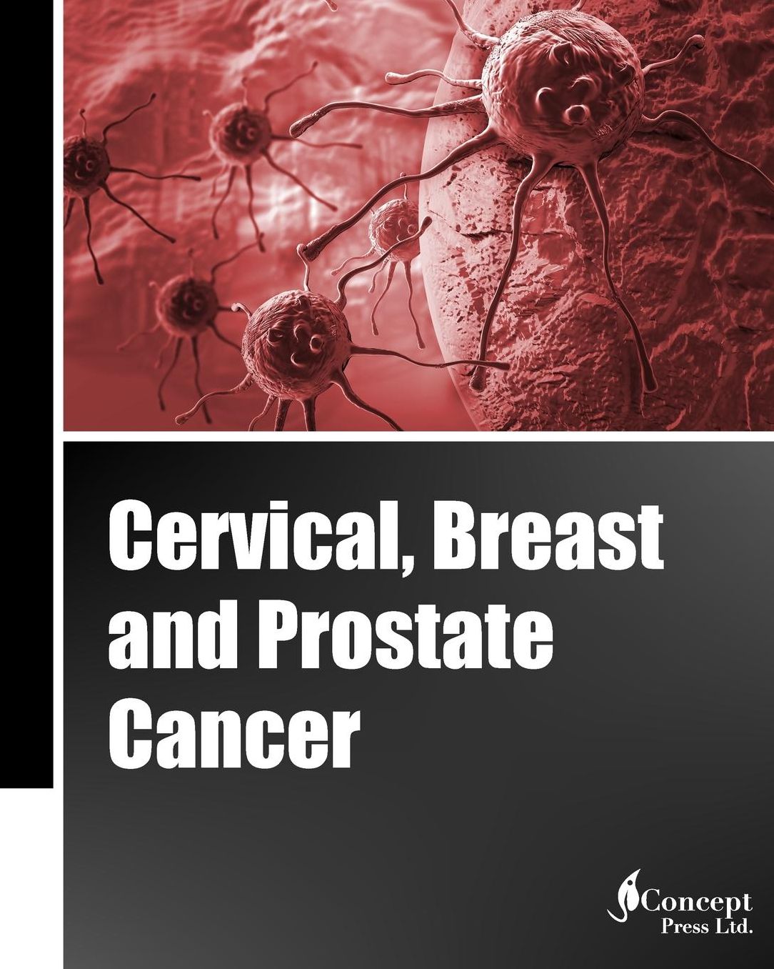 Cervical, Breast and Prostate Cancer (Classical Cover, Black and White)