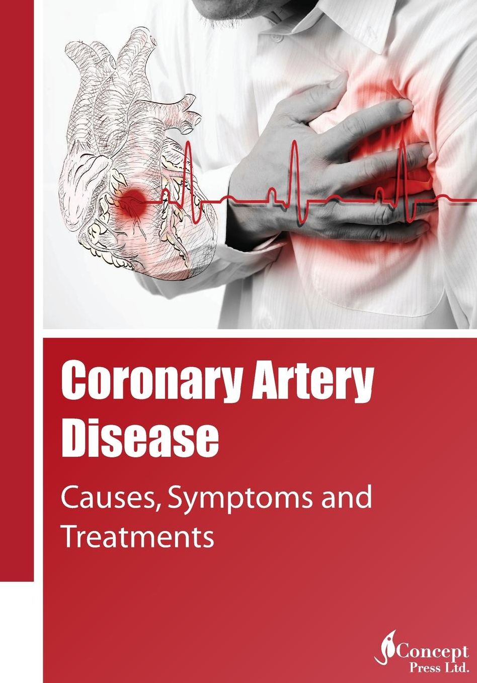 Coronary Artery Disease: Causes, Symptoms and Treatments