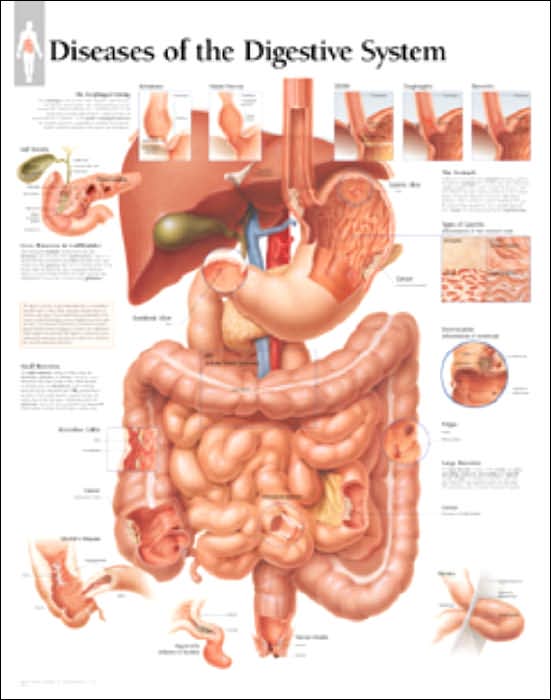 Diseases of the Digestive System Anatomical Chart