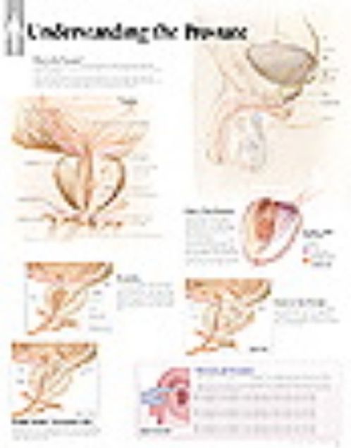 Understanding the Prostate