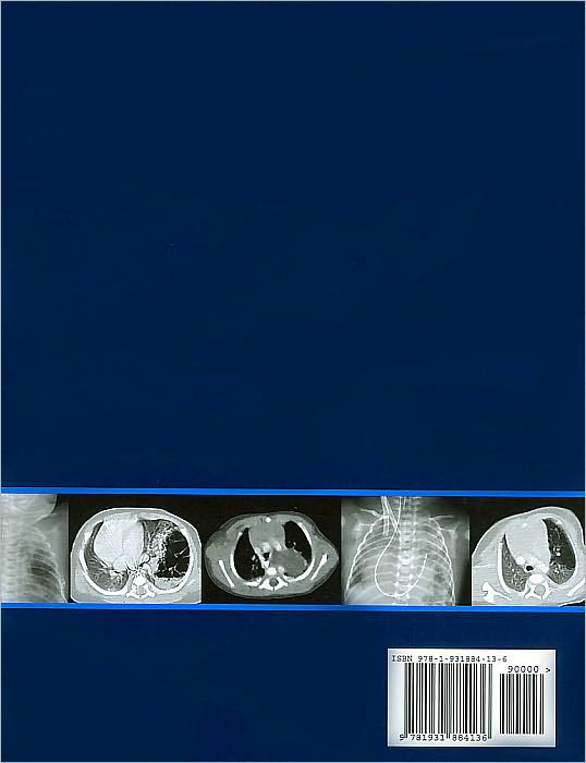 Expert Differential Diagnoses: Pediatrics