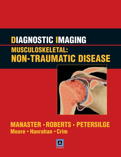 Diagnostic Imaging: Musculoskeletal: Non-Traumatic Disease: Published by Amirsys®