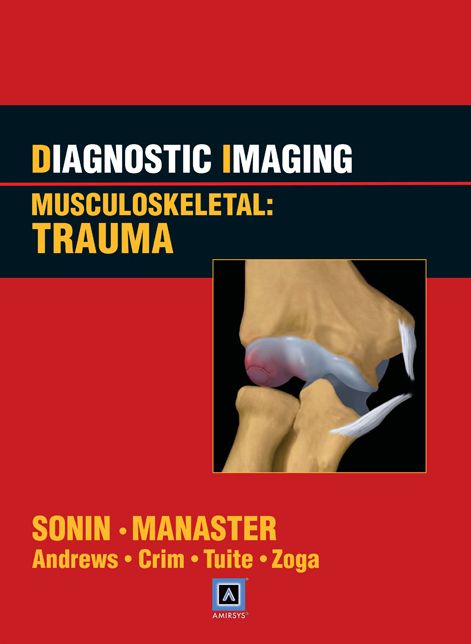 Diagnostic Imaging: Musculoskeletal: Trauma: Published by Amirsys®