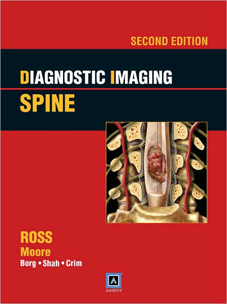 Diagnostic Imaging: Spine: Published by Amirsys