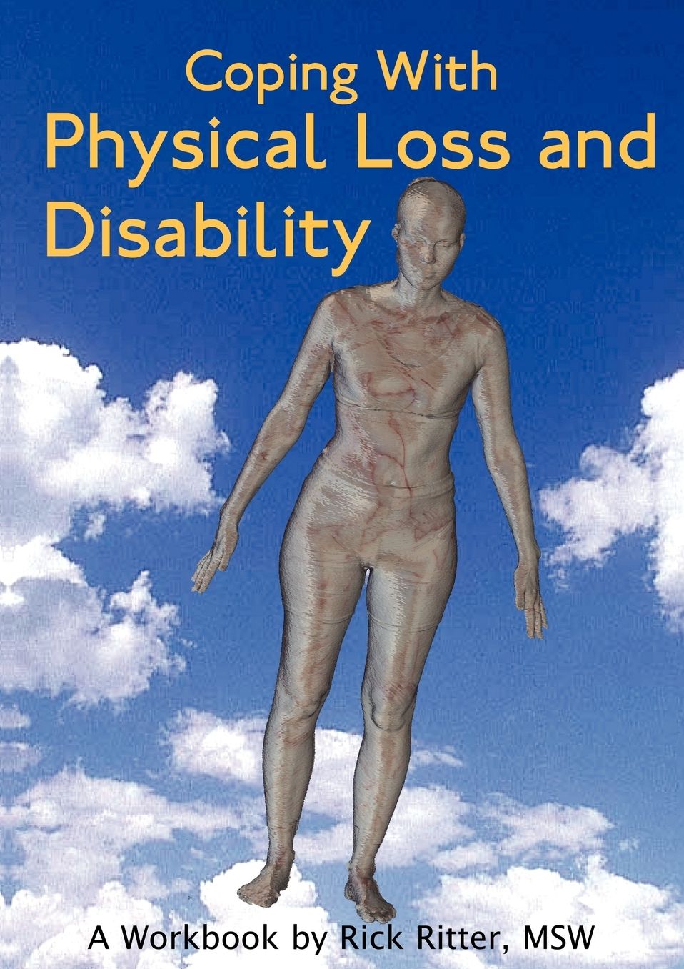 Coping With Physical Loss And Disability