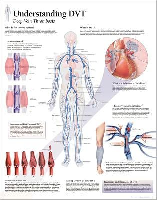 Understanding DVT chart