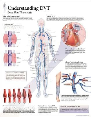 Understanding DVT chart