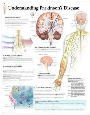 Understanding Parkinson's chart