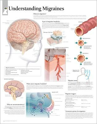Understanding Migraines chart