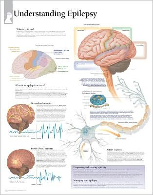 Understanding Epilepsy: Paper