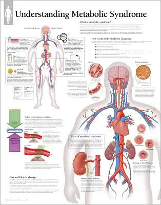 Metabolic Syndrome chart