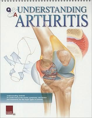 Understanding Arthritis: Flip Chart Book