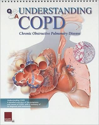 Understanding COPD: Flip Chart Book