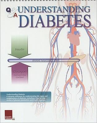 Understanding Diabetes: Flip Chart Book