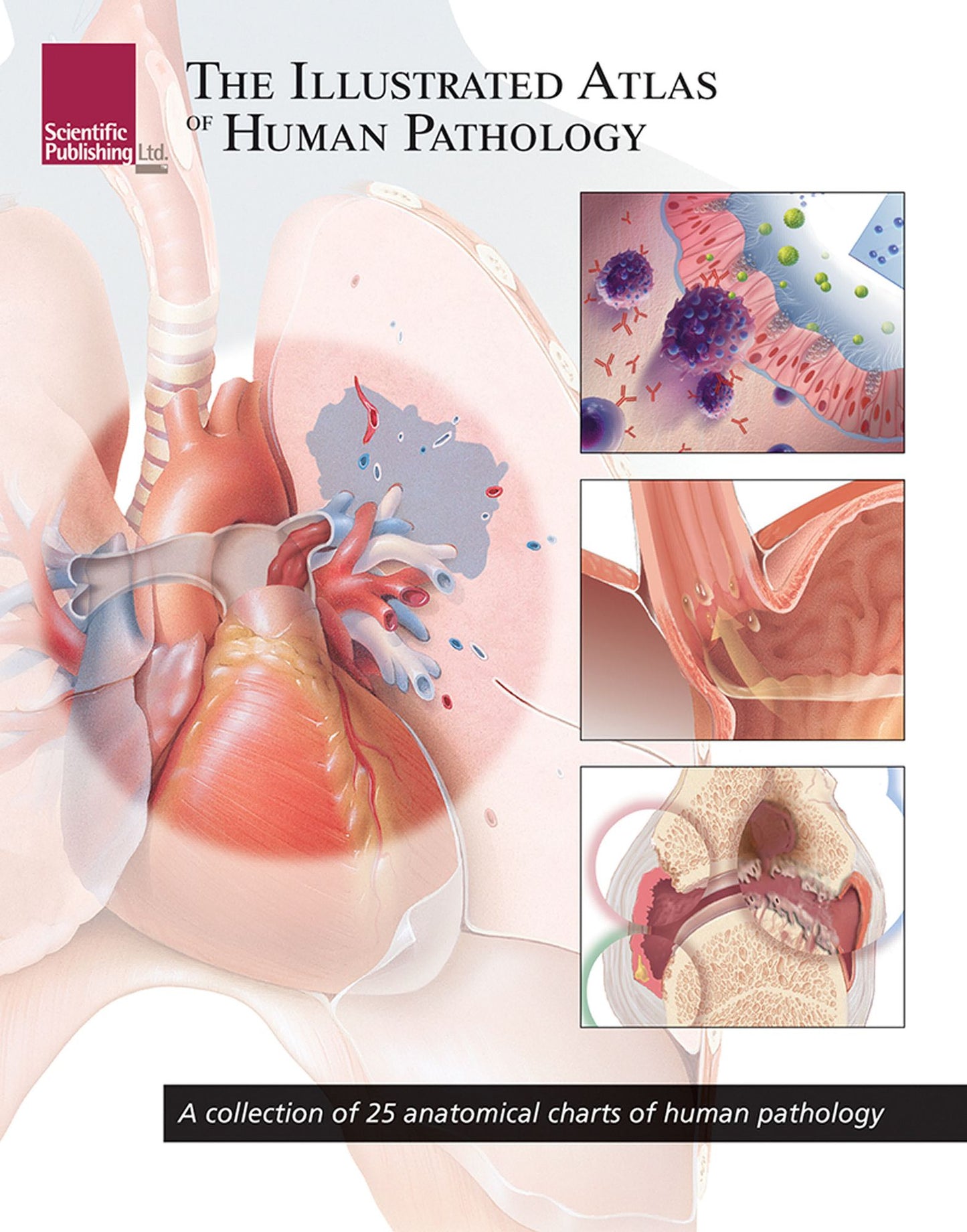 The Illustrated Atlas of Human Pathology