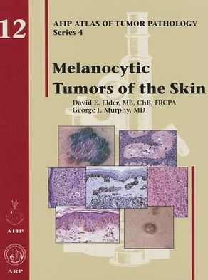 Melanocytic Tumors of the Skin