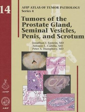 Tumors of the Prostate Gland, Seminal Vesicles, Penis, and Scrotum