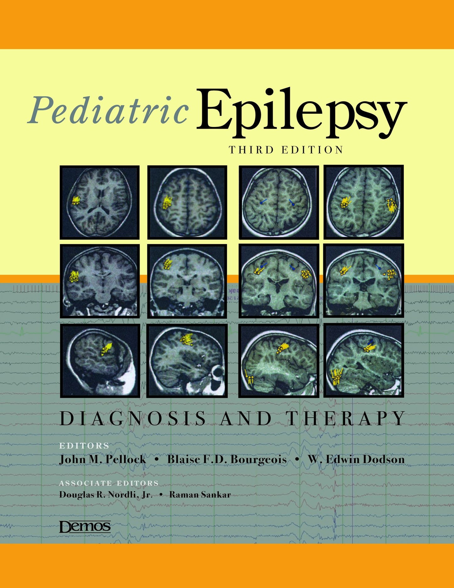 Pediatric Epilepsy: Diagnosis and Therapy :Third Edition