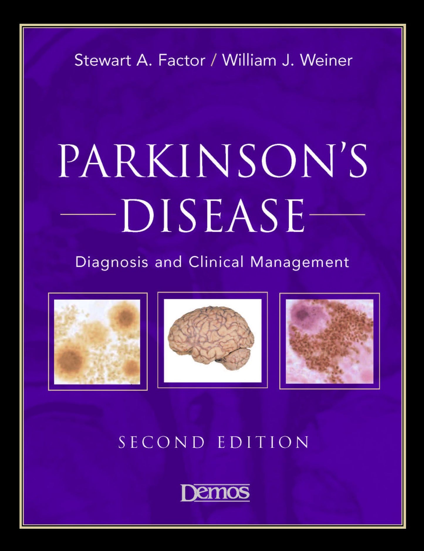 Parkinson's Disease: Diagnosis & Clinical Management : Second Edition