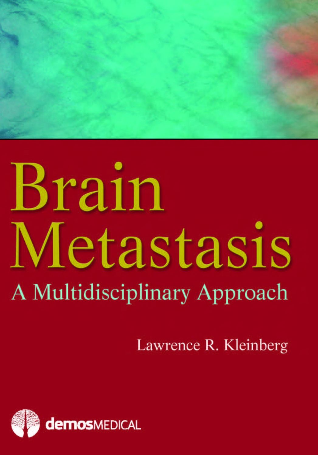 Brain Metastasis: A Multidisciplinary Approach