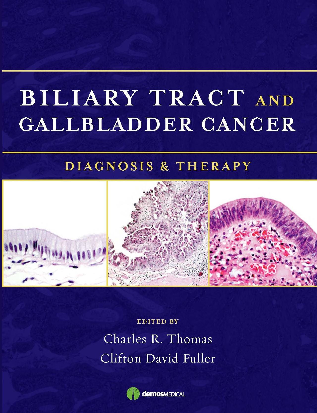 Biliary Tract and Gallbladder Cancer: Diagnosis and Therapy