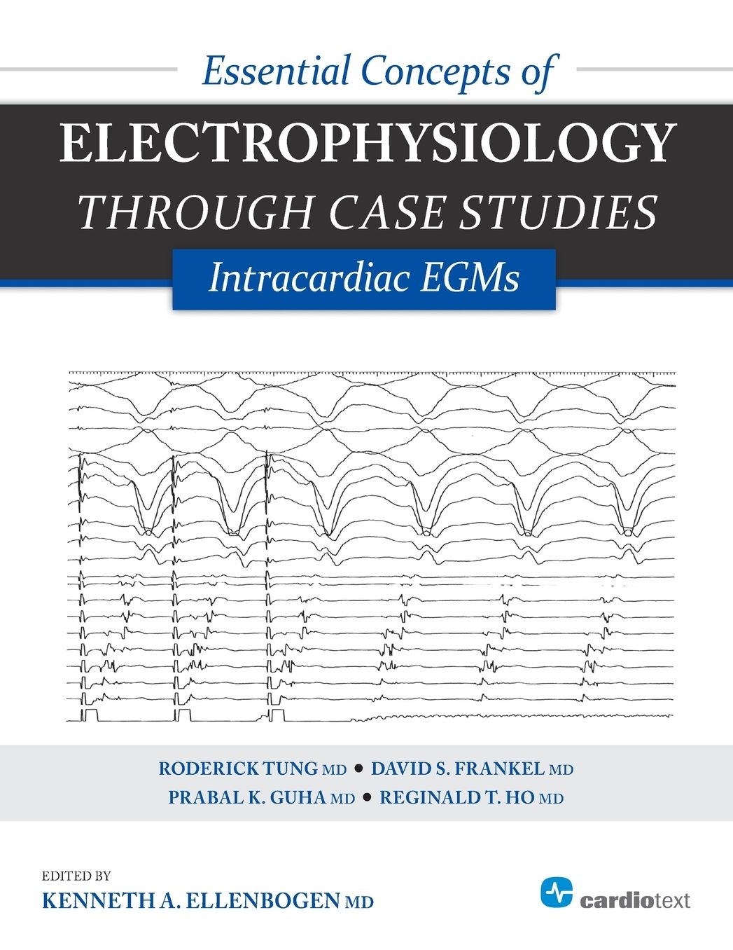 Essential Concepts of Electrophysiology Through Case Studies : Intracardiac EGMs