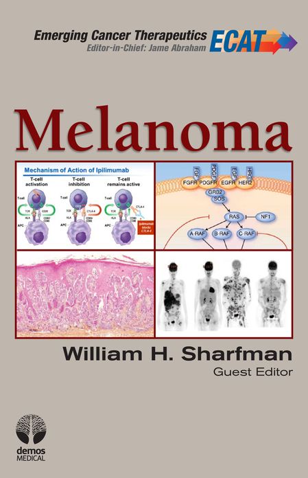 Melanoma