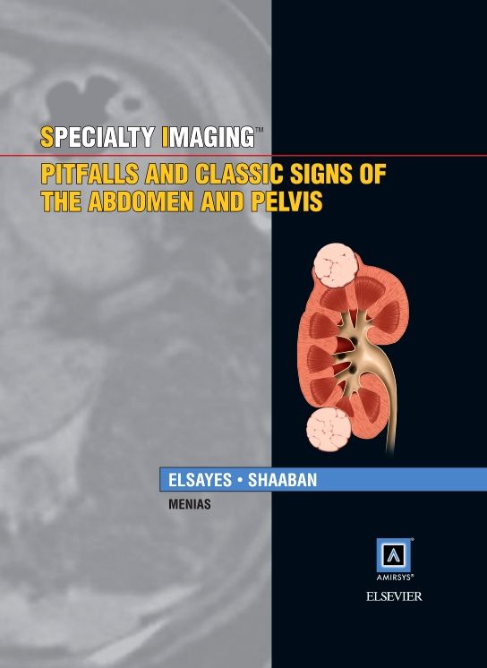 Pitfalls and Classic Signs of the Abdomen and Pelvis