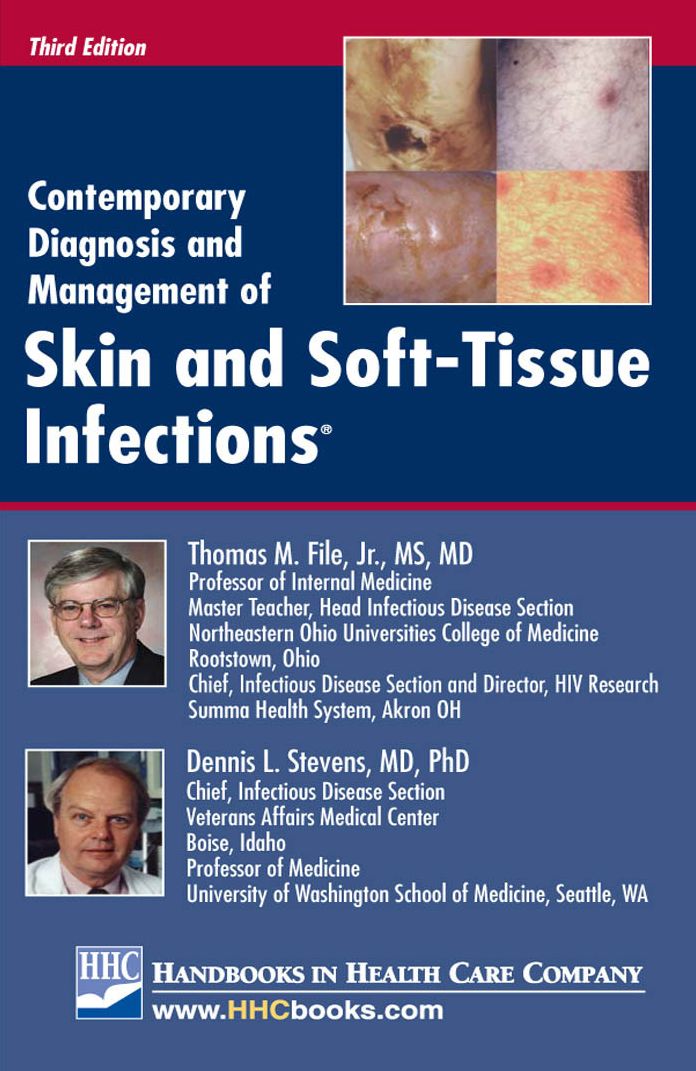 Contemporary Diagnosis and Management of Skin and Soft-Tissue Infections, 3rd edition