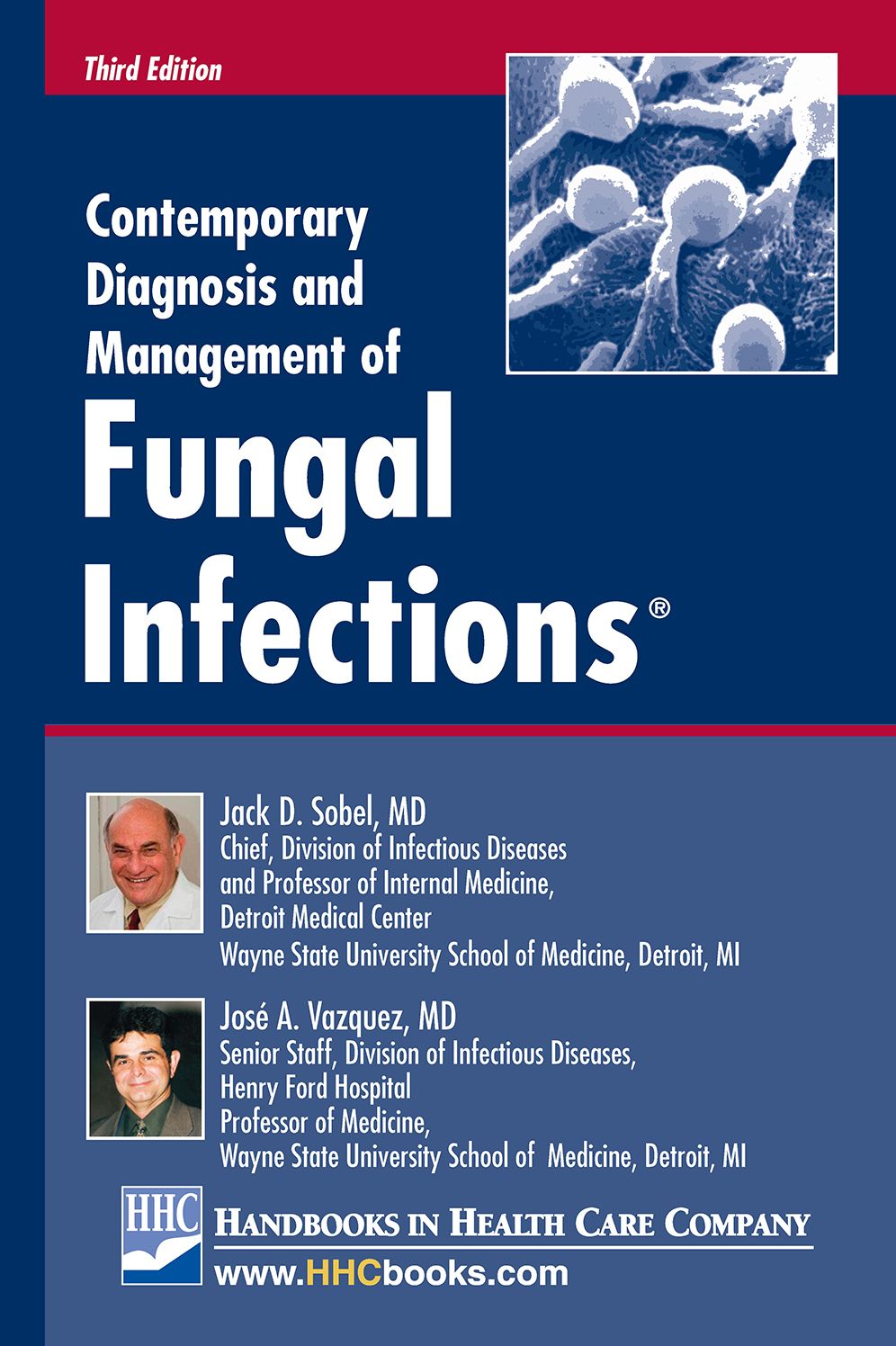 Contemporary Diagnosis and Management of Fungal Infections