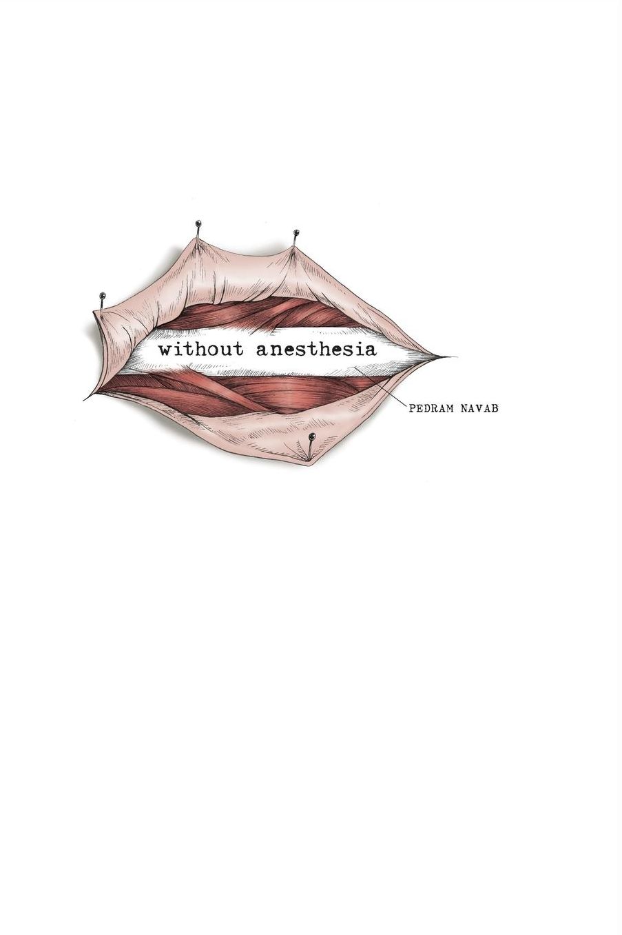 Without Anesthesia: a novel