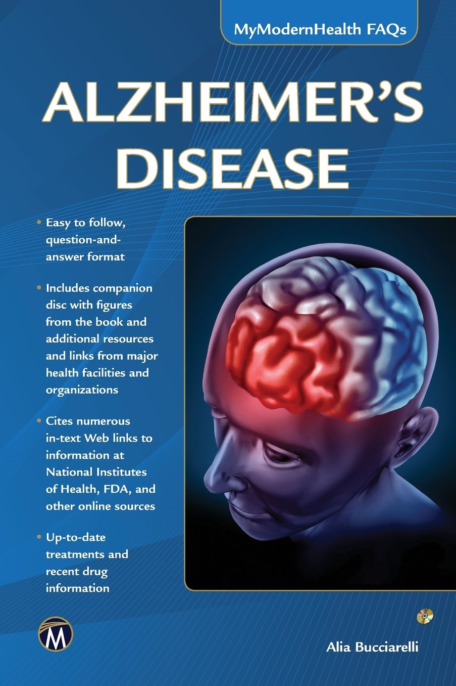 Alzheimer's Disease: MyModernHealth FAQs