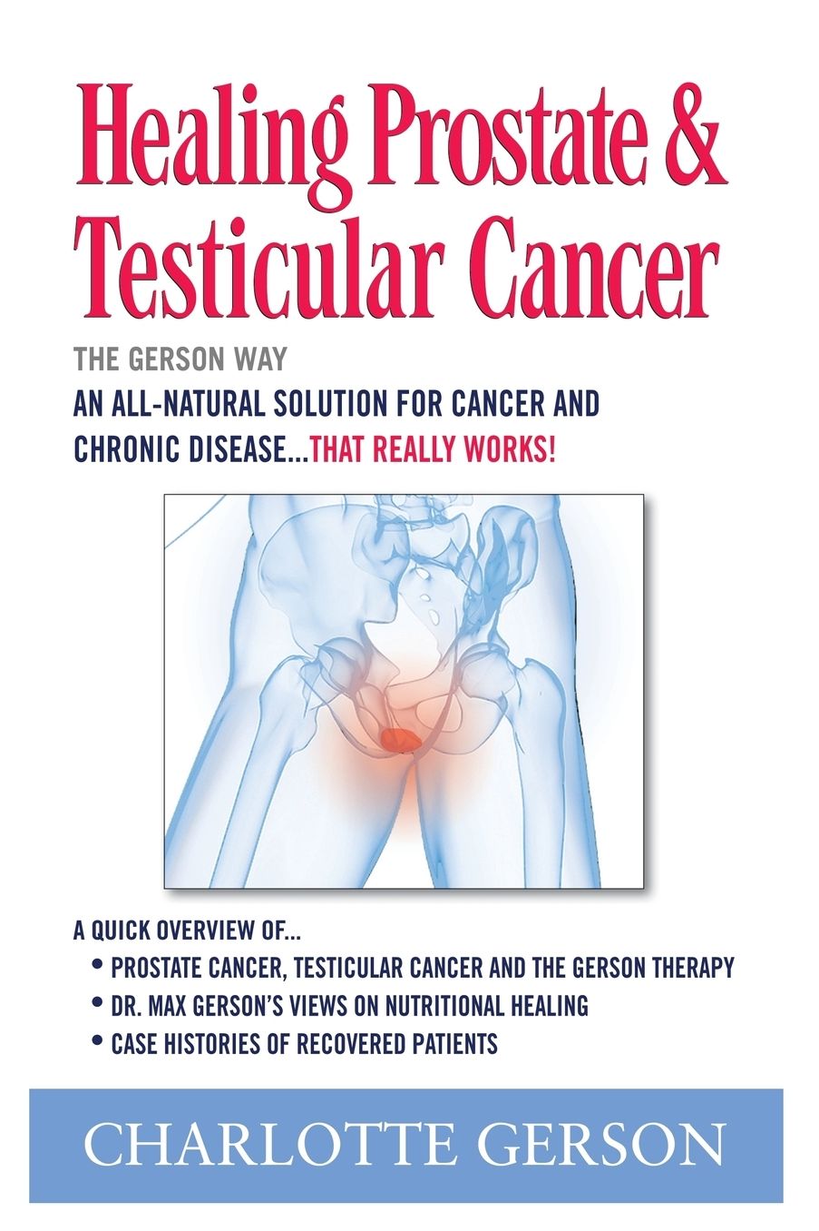 Healing Prostate and Testicular Cancer the Gerson Way