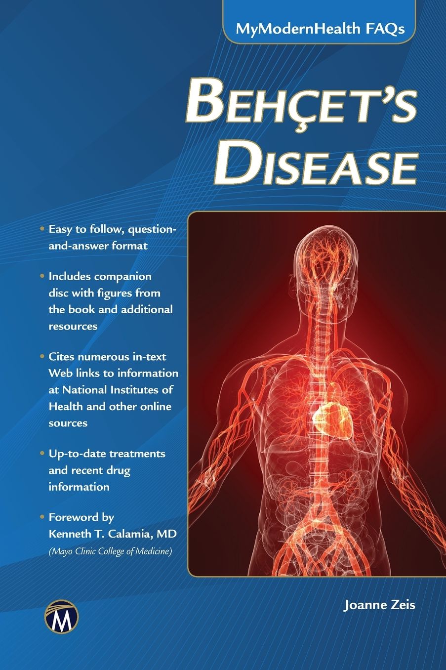 Behcet's Disease