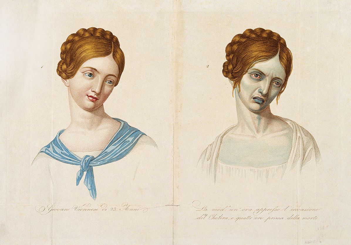The Sick Rose: Disease and the Art of Medical Illustration