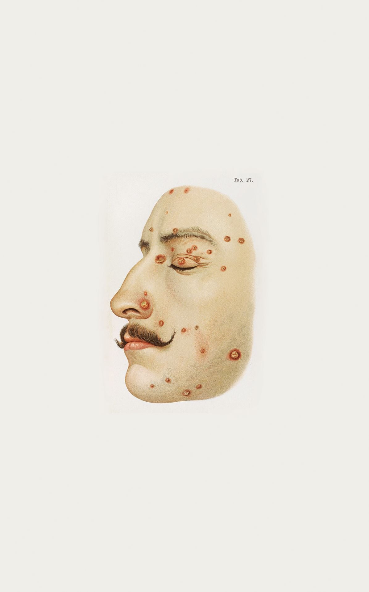 The Sick Rose: Disease and the Art of Medical Illustration