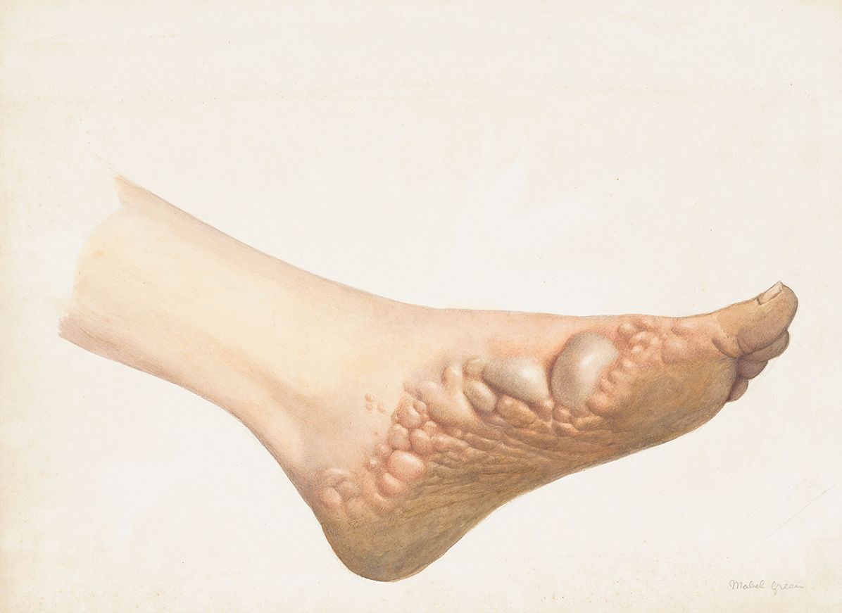 The Sick Rose: Disease and the Art of Medical Illustration