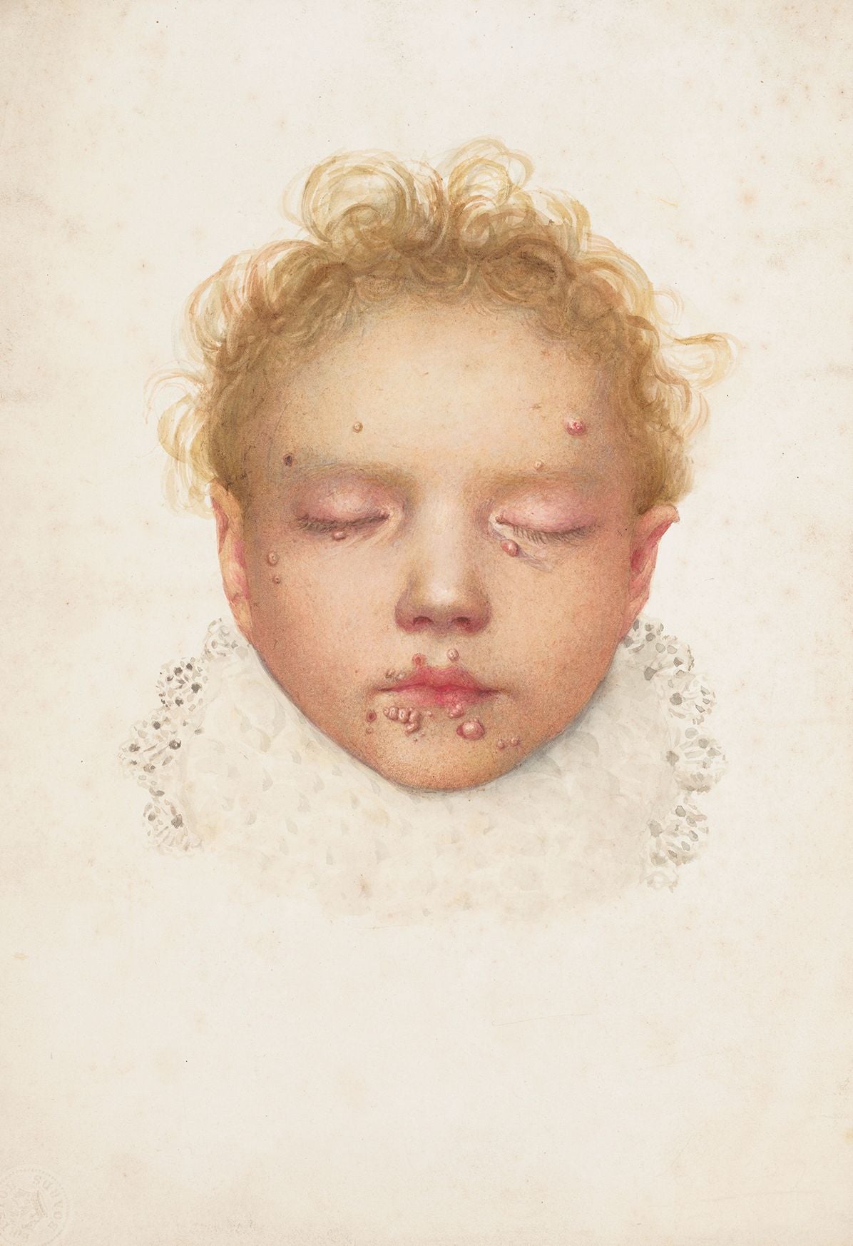 The Sick Rose: Disease and the Art of Medical Illustration