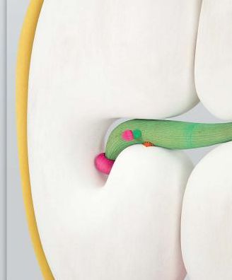 Matthew Ronay