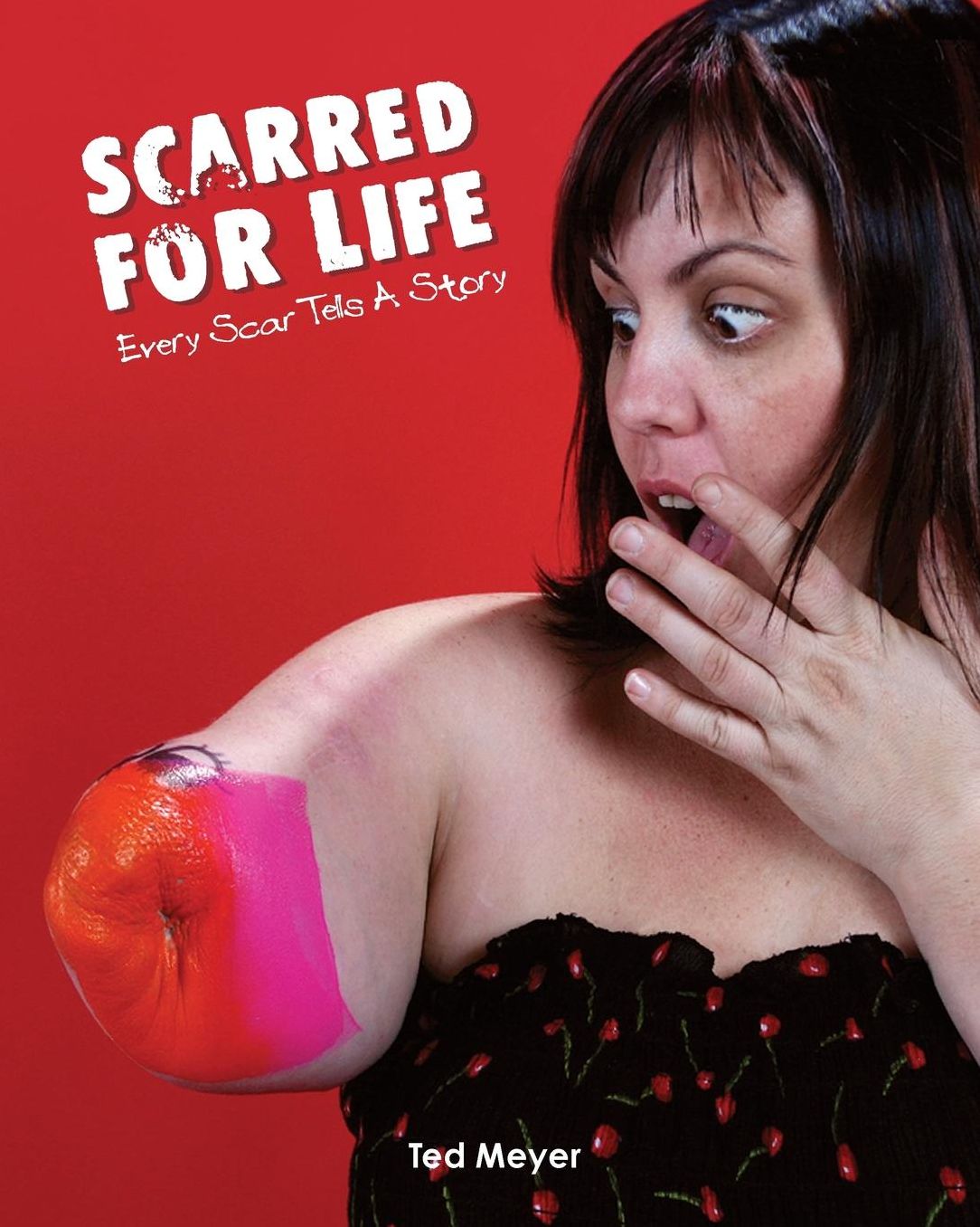 Scarred for Life: Every Scar Tells a Story